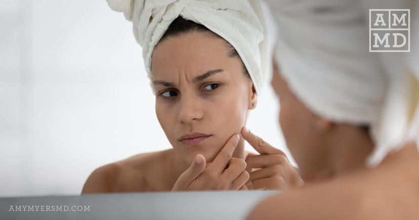 Does Hormone Replacement Therapy Cause Adult Acne?