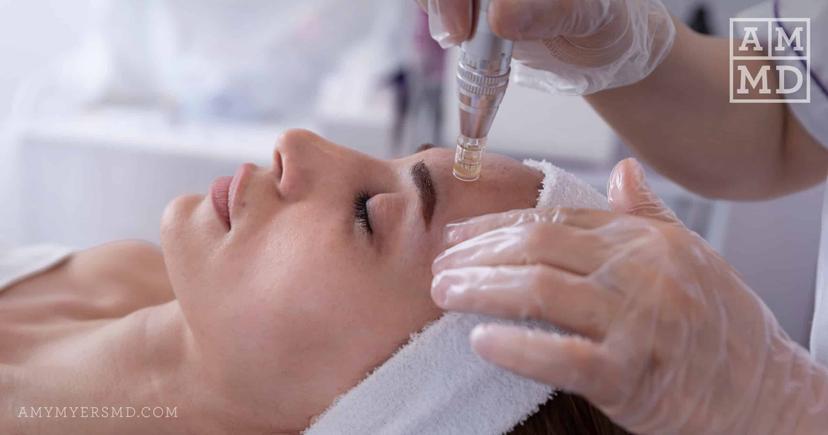 7 Alternatives to Botox and Plastic Surgery