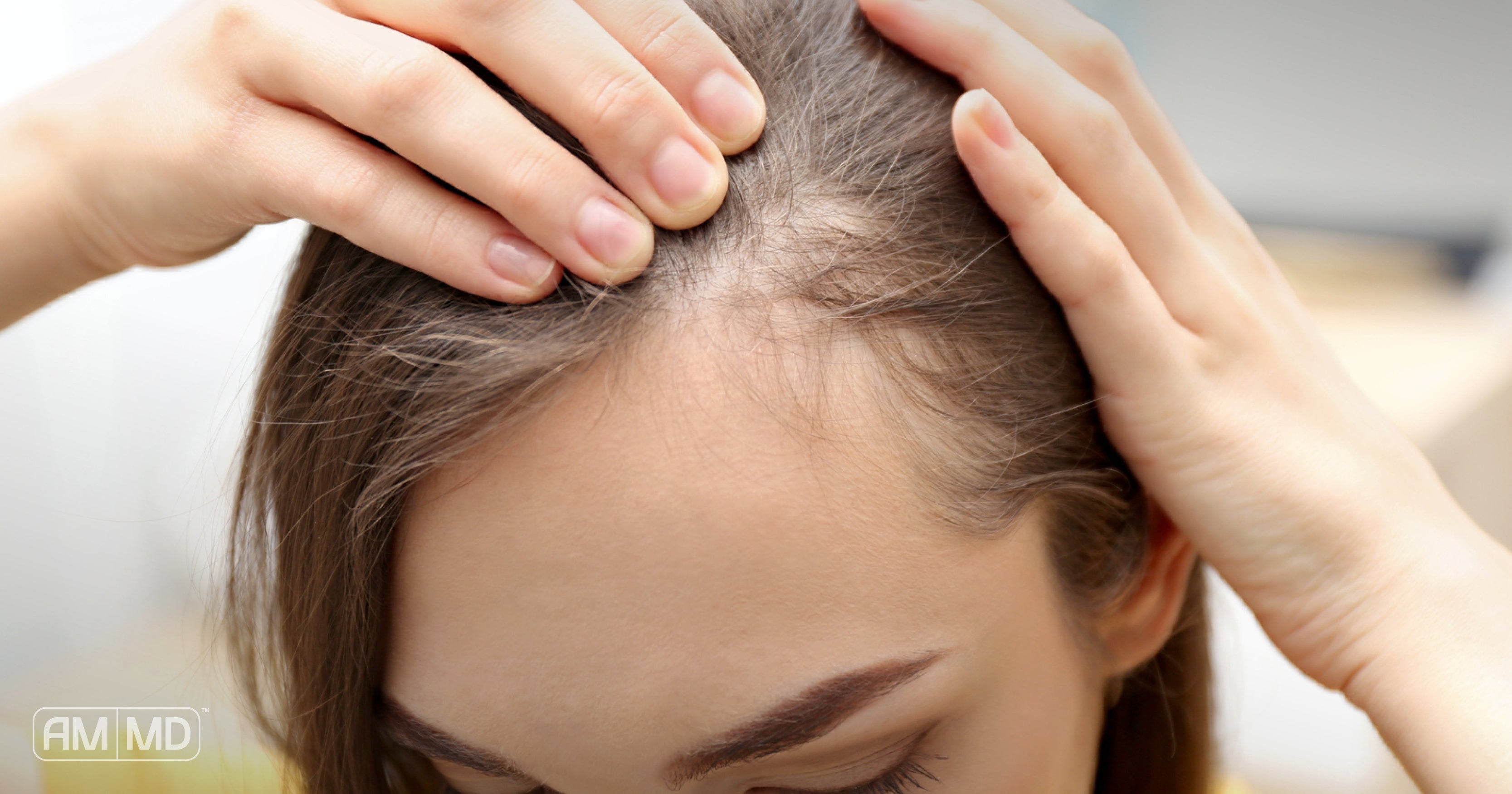 Girl touching hair and looking at scalp - How to Reverse Lupus Naturally - AMMD™