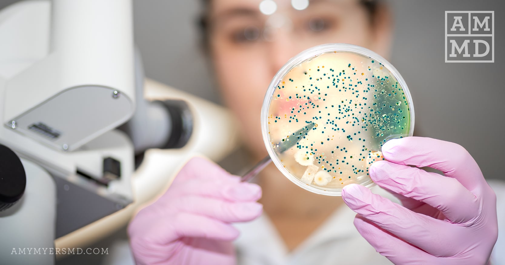 Scientist holds up microbes in a petri dish