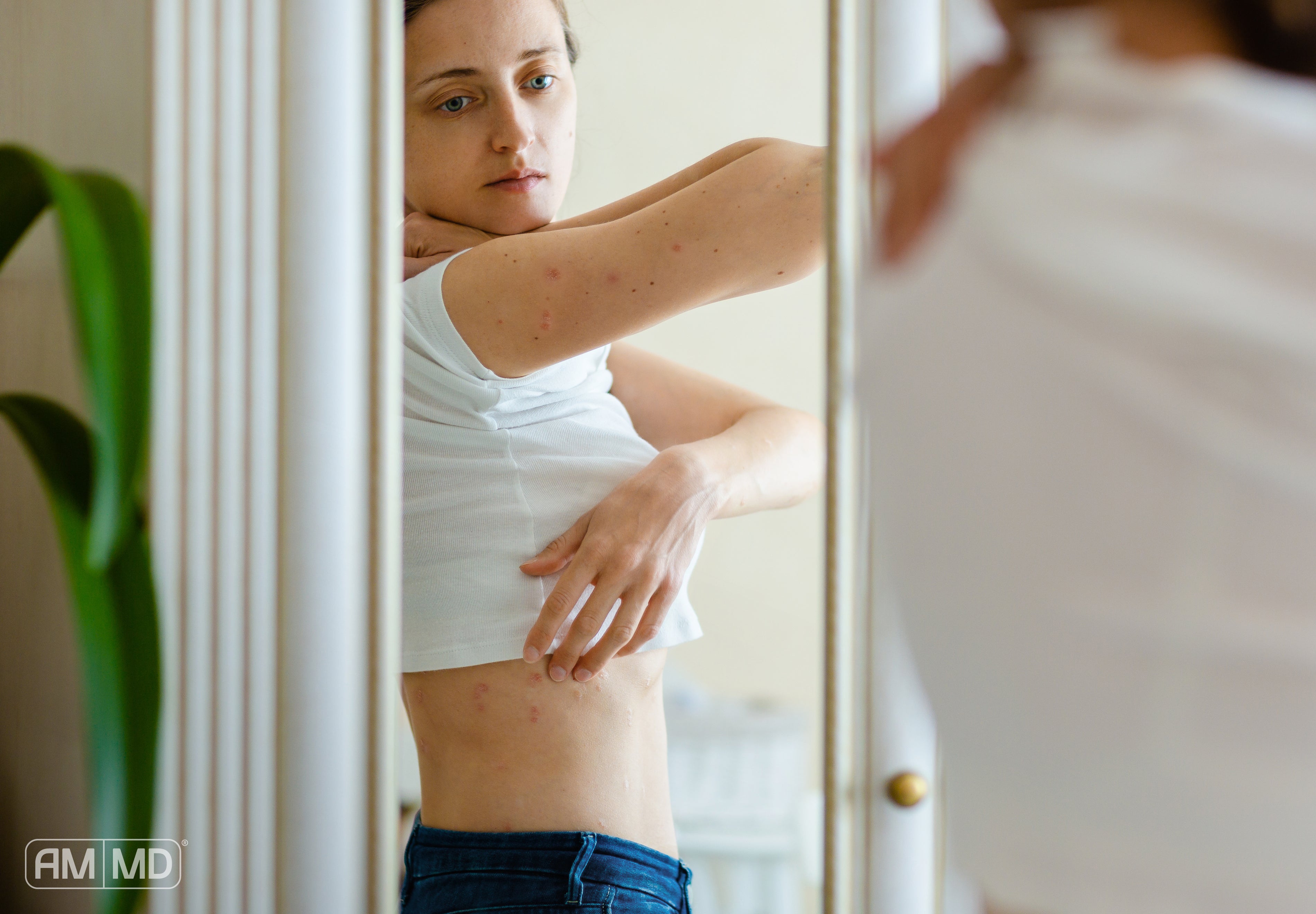 Woman inspecting skin issues - What Triggers Autoimmune Diseases? Understanding Causes and Risk Factors - AMMD™